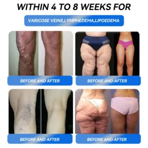 【Flagship store】✅ IFMAGIC® GLP-1 Pro Weight Loss Oral Solutio (𝐉𝐮𝐬𝐭 𝐨𝐧𝐜𝐞 𝐚 𝐝𝐚𝐲, 𝐯𝐢𝐬𝐢𝐛𝐥𝐞 𝐜𝐡𝐚𝐧𝐠𝐞𝐬 𝐢𝐧 𝟕 𝐝𝐚𝐲𝐬) 𝐅𝐨𝐫 𝐨𝐛𝐞𝐬𝐢𝐭𝐲, 𝐜𝐚𝐫𝐝𝐢𝐨𝐯𝐚𝐬𝐜𝐮𝐥𝐚𝐫 𝐡𝐞𝐚𝐥𝐭𝐡, 𝐝𝐢𝐚𝐛𝐞𝐭𝐞𝐬, 𝐬𝐥𝐞𝐞𝐩 𝐚𝐩𝐧𝐞𝐚, 𝐆𝐮𝐭 𝐇𝐞𝐚𝐥𝐭𝐡, 𝐣𝐨𝐢𝐧𝐭 𝐢𝐬𝐬𝐮𝐞𝐬, 𝐚𝐧𝐝 𝐦𝐨𝐫𝐞👨🔬