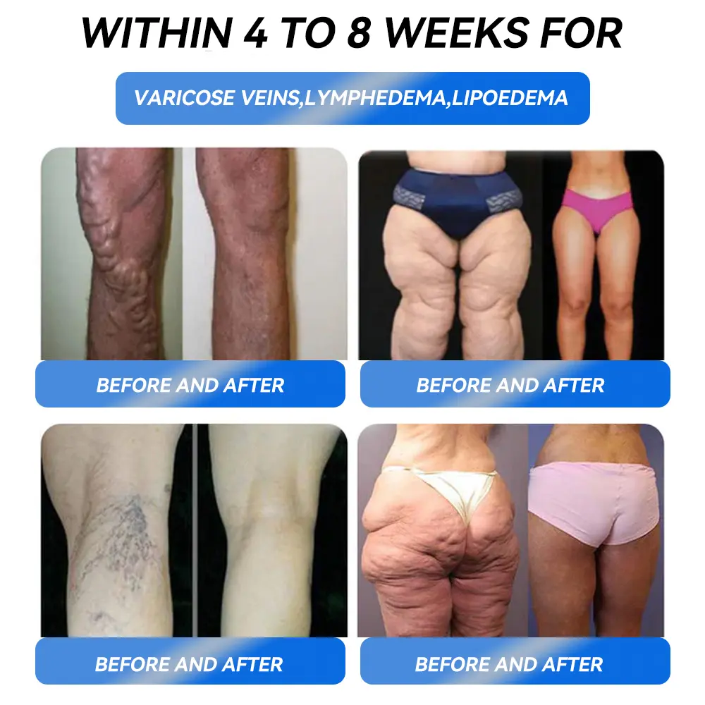 【Flagship store】✅ IFMAGIC® GLP-1 Pro Weight Loss Oral Solutio (𝐉𝐮𝐬𝐭 𝐨𝐧𝐜𝐞 𝐚 𝐝𝐚𝐲, 𝐯𝐢𝐬𝐢𝐛𝐥𝐞 𝐜𝐡𝐚𝐧𝐠𝐞𝐬 𝐢𝐧 𝟕 𝐝𝐚𝐲𝐬) 𝐅𝐨𝐫 𝐨𝐛𝐞𝐬𝐢𝐭𝐲, 𝐜𝐚𝐫𝐝𝐢𝐨𝐯𝐚𝐬𝐜𝐮𝐥𝐚𝐫 𝐡𝐞𝐚𝐥𝐭𝐡, 𝐝𝐢𝐚𝐛𝐞𝐭𝐞𝐬, 𝐬𝐥𝐞𝐞𝐩 𝐚𝐩𝐧𝐞𝐚, 𝐆𝐮𝐭 𝐇𝐞𝐚𝐥𝐭𝐡, 𝐣𝐨𝐢𝐧𝐭 𝐢𝐬𝐬𝐮𝐞𝐬, 𝐚𝐧𝐝 𝐦𝐨𝐫𝐞👨🔬